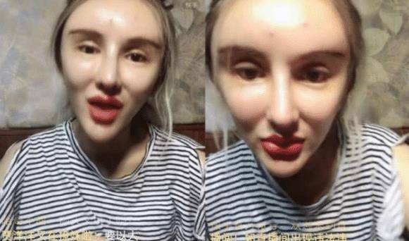 16岁开始整容,花400多万整容200余次的"红粉宝宝",如今怎样?