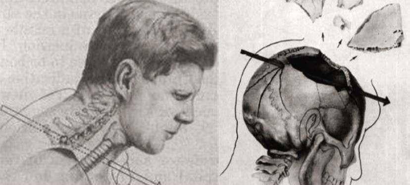 为何"肯尼迪遇刺"成为悬案,那颗子弹又被称为"魔术子弹"