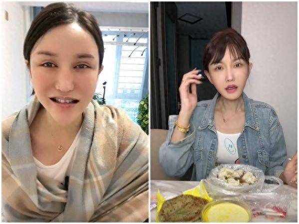 陆网红一笑「脸歪嘴斜」后悔:没回头路可走_美娜_牙齿_手术
