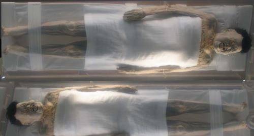 弹性,四肢关节仍然可以活动;2001年在安徽出土的清代女尸也是面色红润