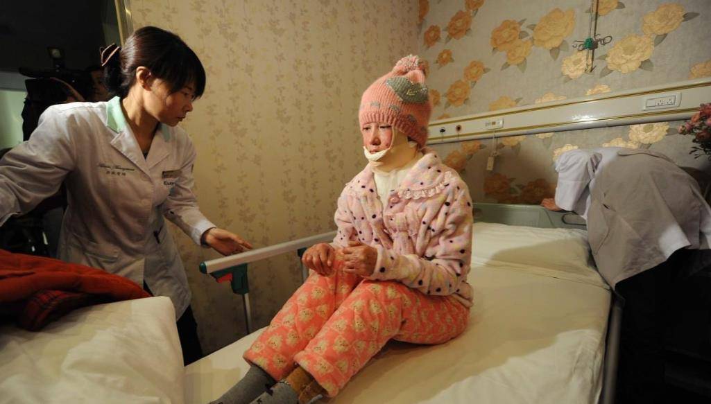 10年前合肥女孩拒绝同学求爱,竟遭对方一把火毁容,如今怎么样了