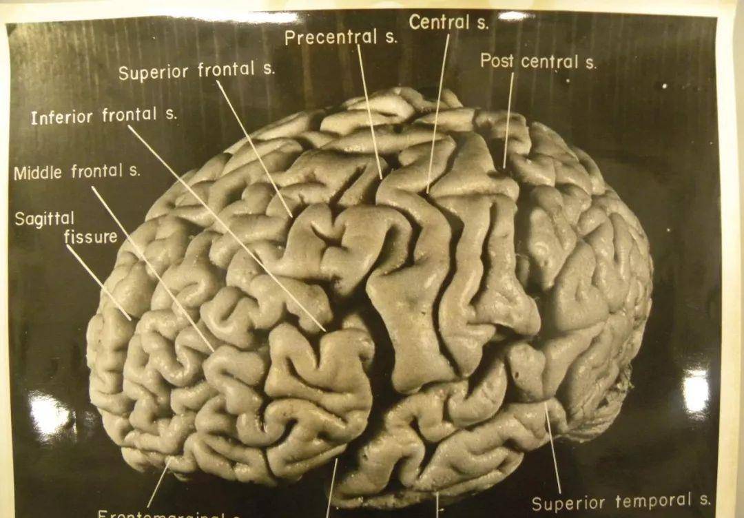 爱因斯坦去世后,大脑被分成240块切片,研究发现与常人不同