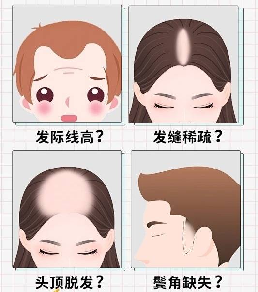 25 脱发生发增发密发哪个牌子好?榜一配享太庙