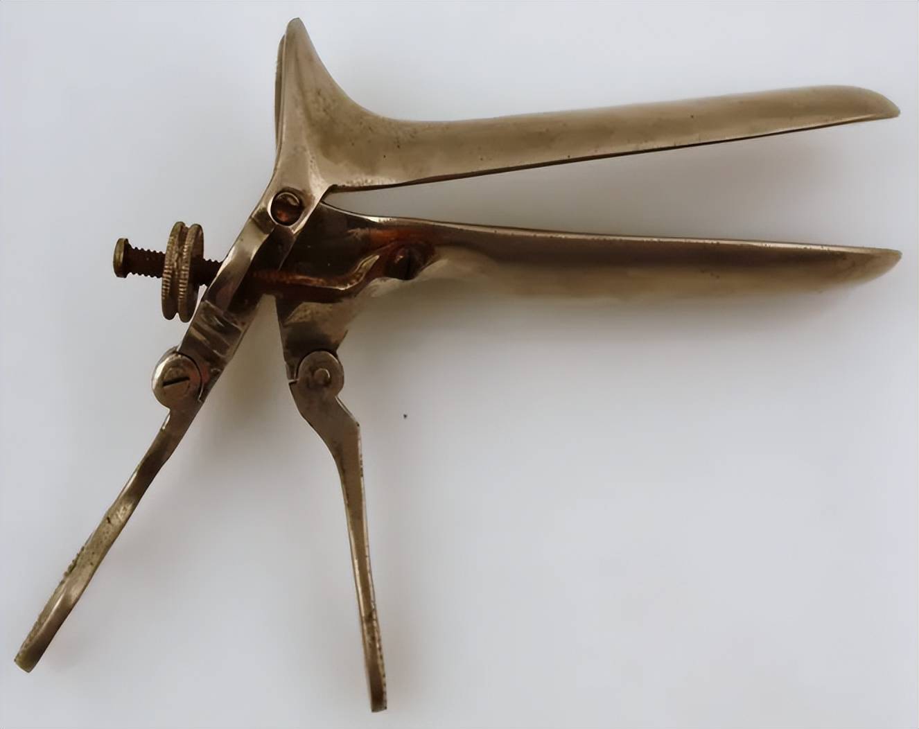 生娃10年后,我却依然害怕"妇科检查"!