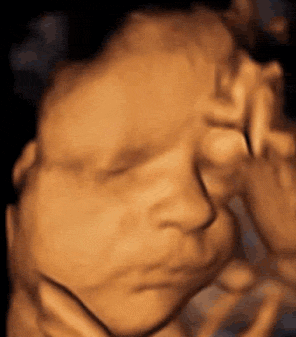 胎儿b超图详解图片