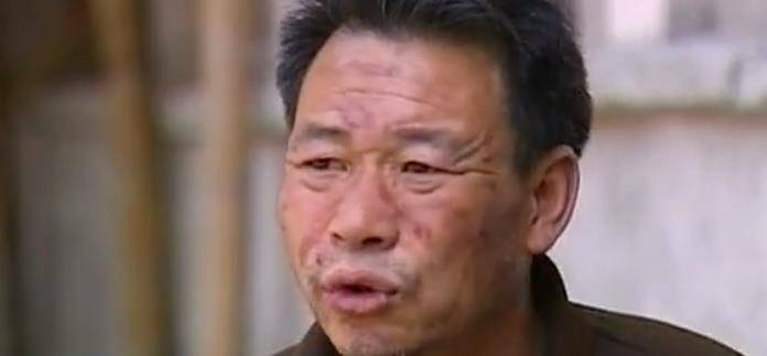 惊讶!浙江大叔"百毒不侵",喝"甲醛"毫发无损,专家发现端倪