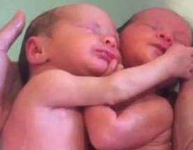 医生把双胞胎宝宝放在水里，但宝宝以为自己还没出生，画面温馨_子_时_母。