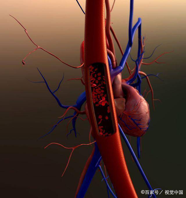 冬季一不注意,心脑血管可能瞬间出事,这4件事一定要当心_张大爷_疾病