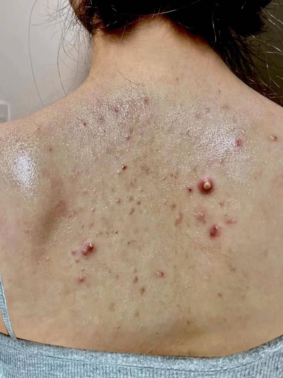 常用的沐浴露换成了除螨沐浴露(从某宝上看好评比较多入的赫舒清皂液)