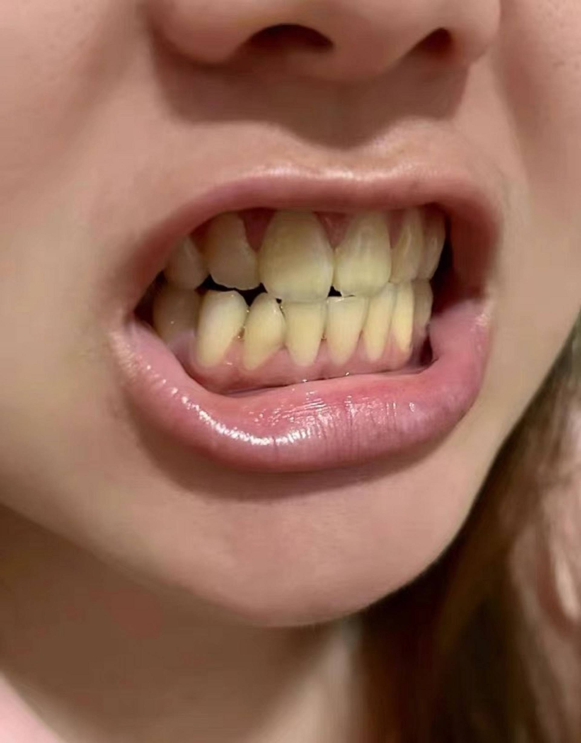 别管用多好看的口红都是白搭,反而还会显得牙齿更黄了,不仅