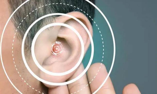 开放式耳机哪个牌子的好用?五大宝藏品牌推荐!