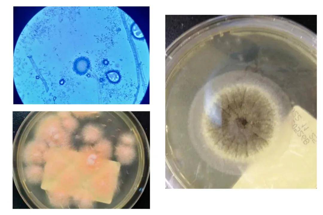 科普丨周口市眼科中的角膜刮片检查有什么作用?