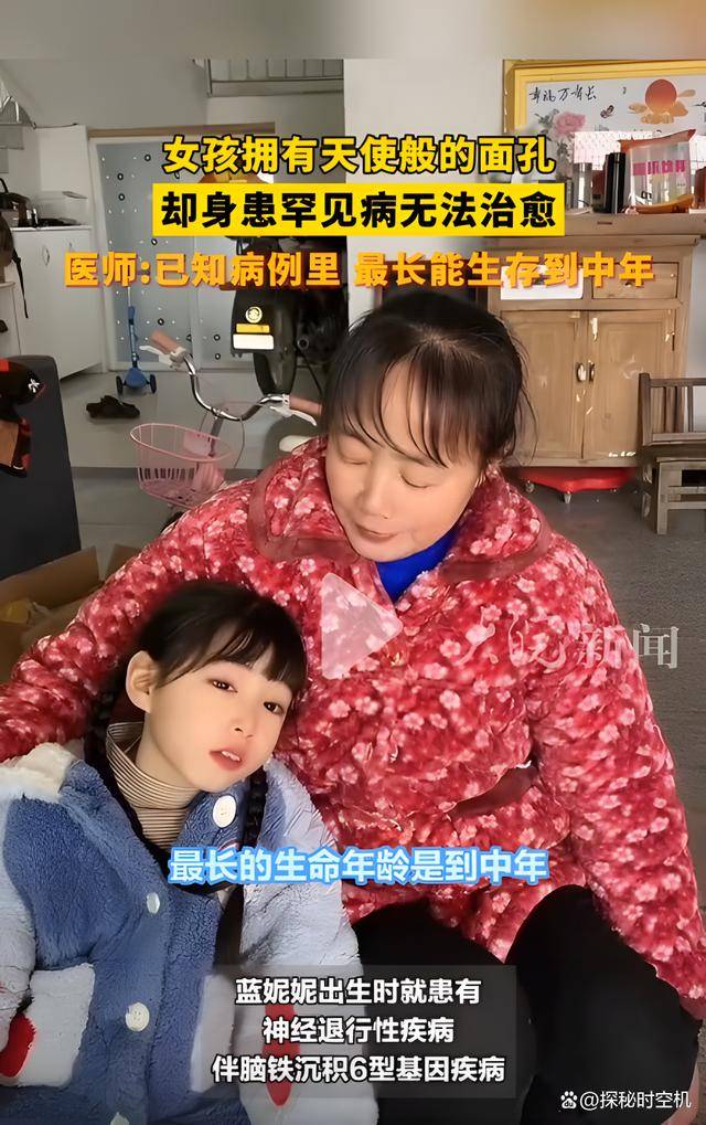8岁女孩颜值逆天却患"不治之症",全球仅6例,会慢慢变成植物人