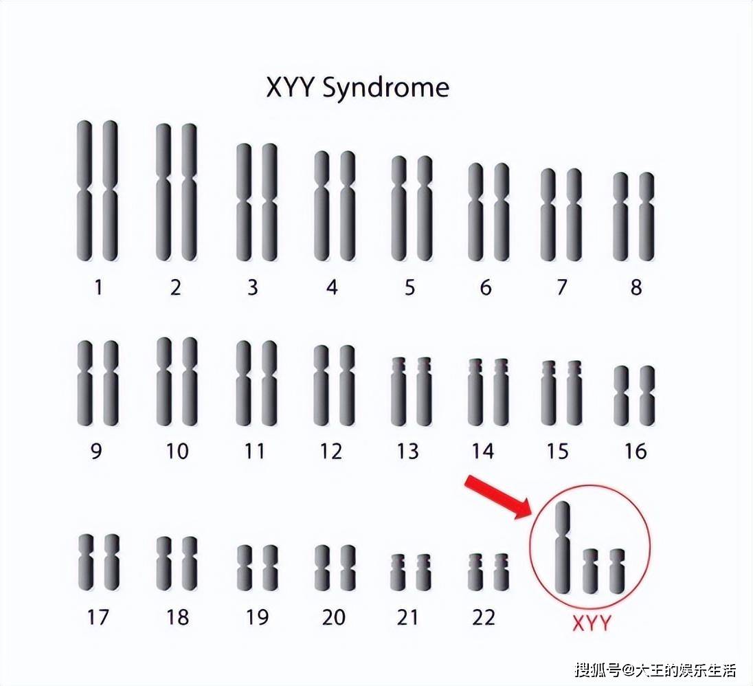 终止妊娠证明模板图片