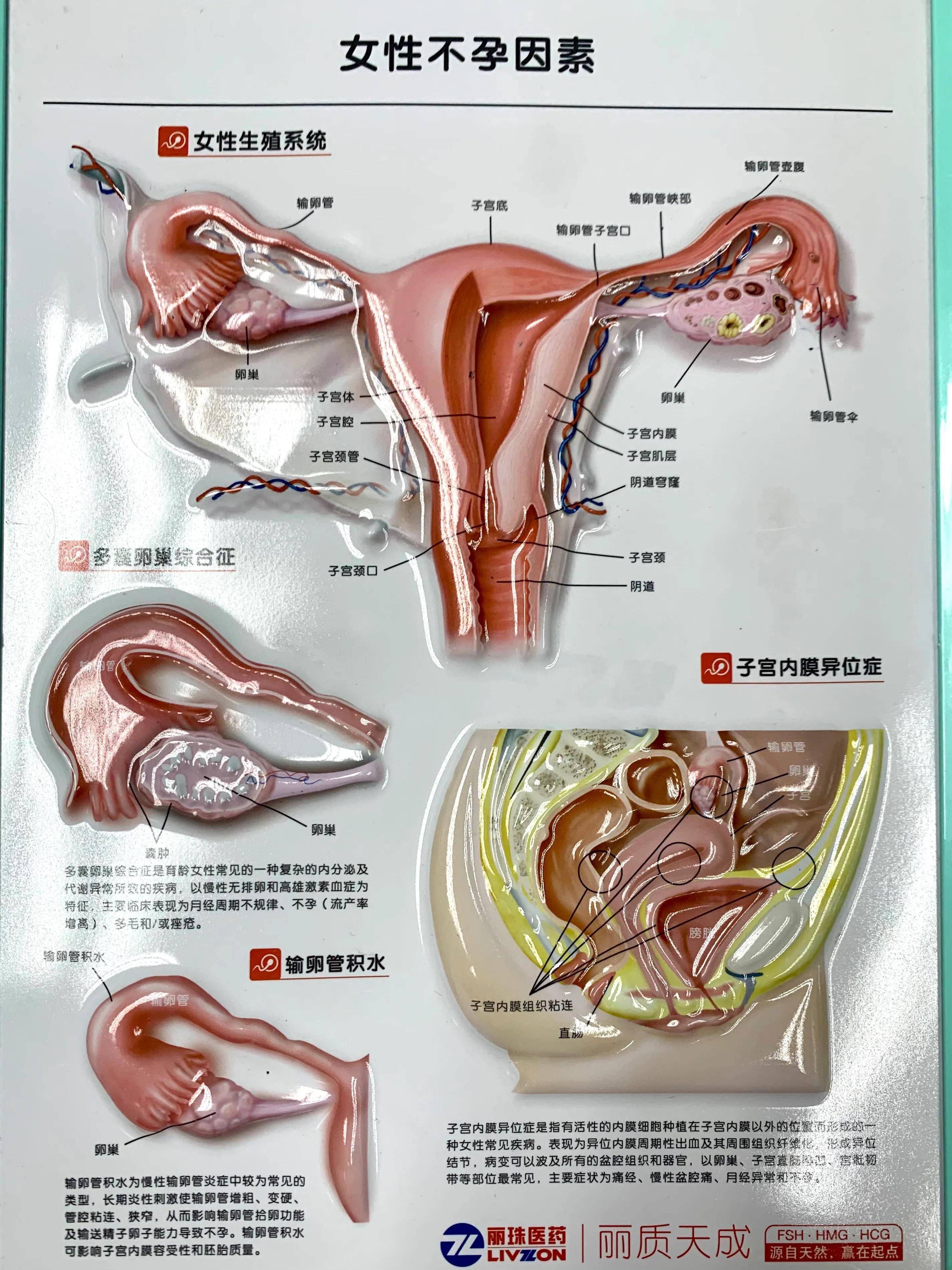 药师真事儿,特别的科普故事_输卵管_感觉_造影