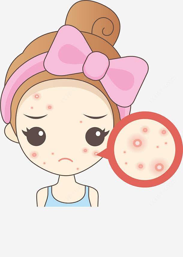 祛痘产品排行榜10强!告别痘痘,助您重拾自信笑容