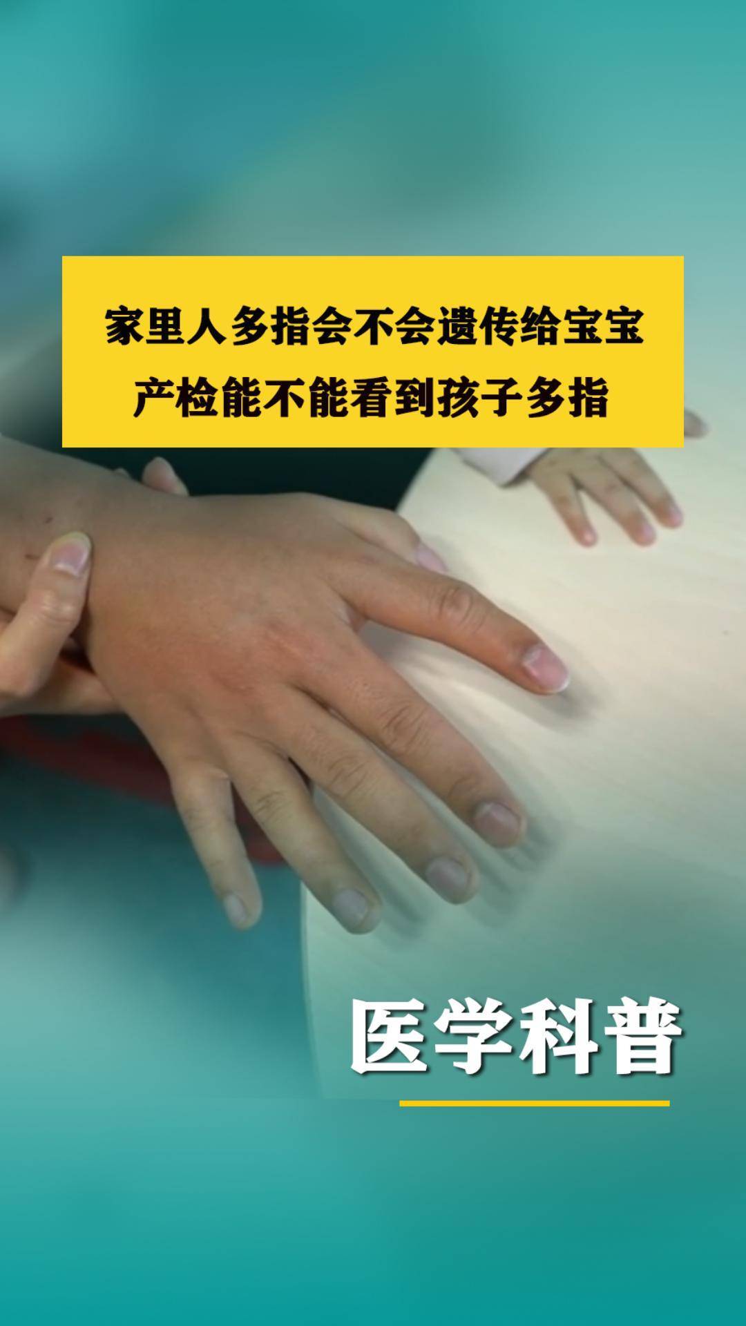 家里人多指会不会遗传给宝宝,产检能不能看到孩子多指