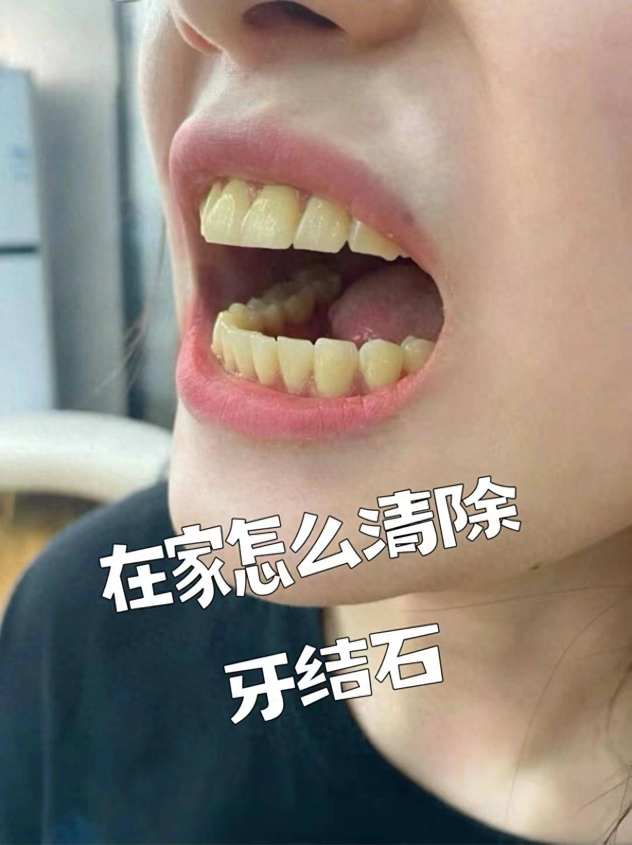 问题_牙粉_少放