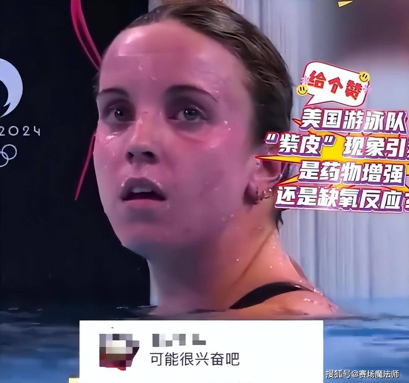 揭秘"紫皮脸"背后的故事_检测_伊恩·索普_问题