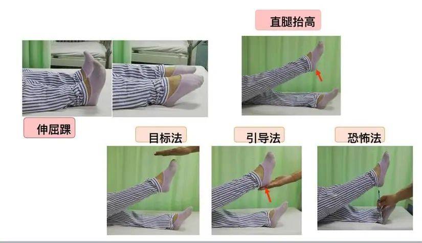肌肉萎缩患者注意:医生提醒科学锻炼恢复肌肉力量要这样做