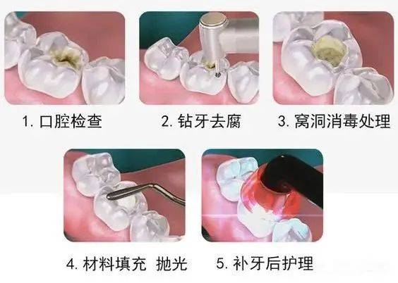 涿州牙齿矫正：重塑美丽笑容的力量