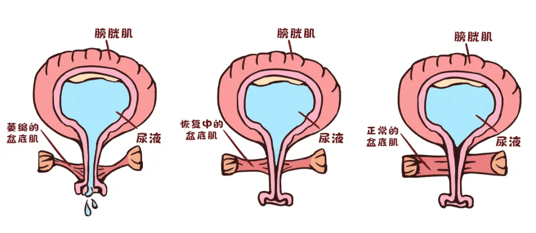 孕期憋尿有什么影响(孕妇经常憋尿对胎儿有什么影响)