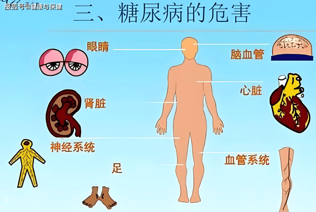 糖化危害图片