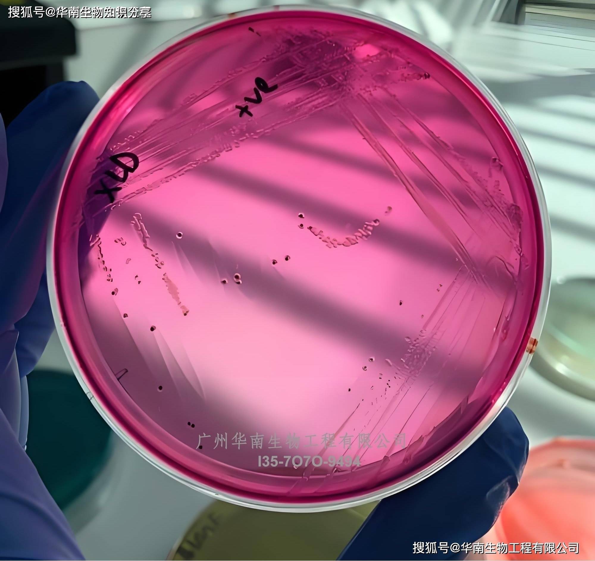 63301光滑念珠菌atcc 15126克柔假丝酵母菌