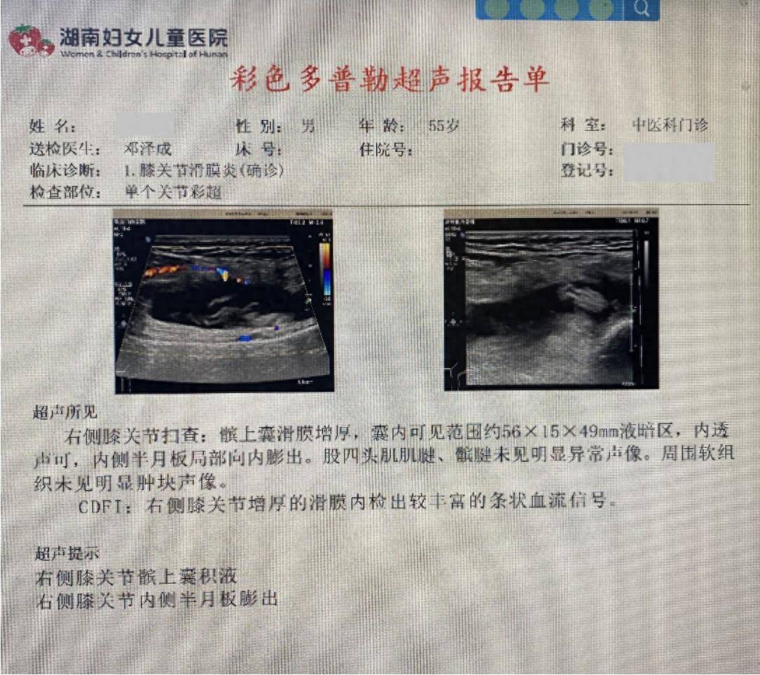 膝痹西医诊断图片