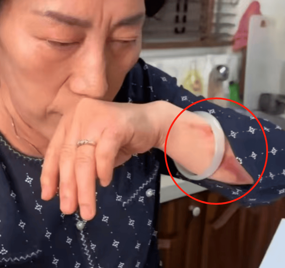 乔任梁父母发声后受伤照曝光!被询问后迅速删除,林更新关评论区
