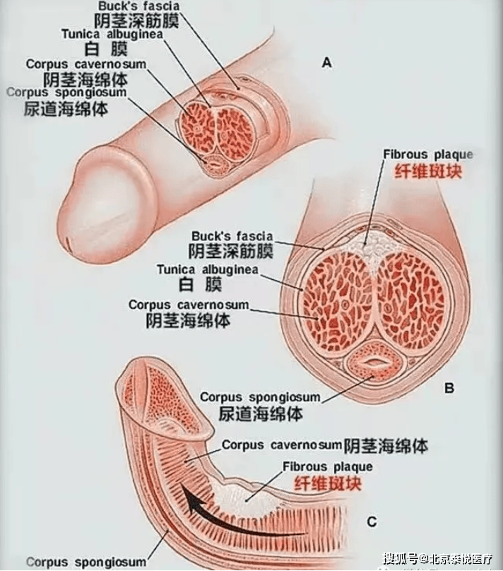 男生的小丁丁向上图片