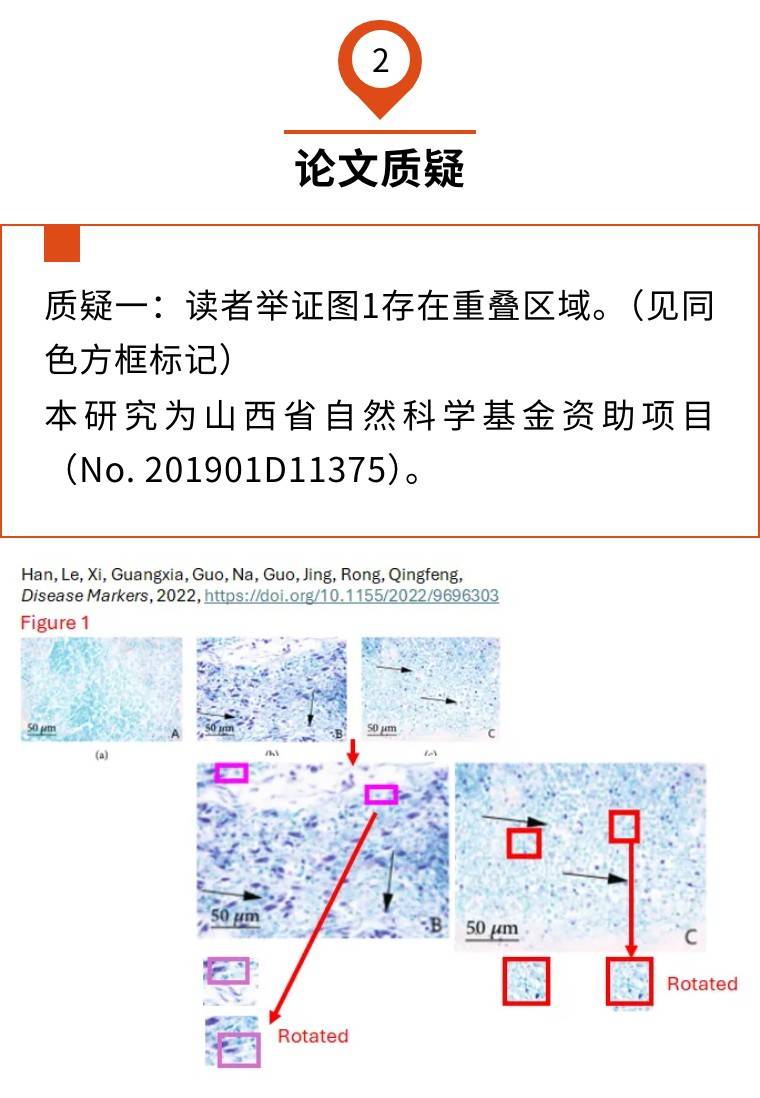 lfb染色图片