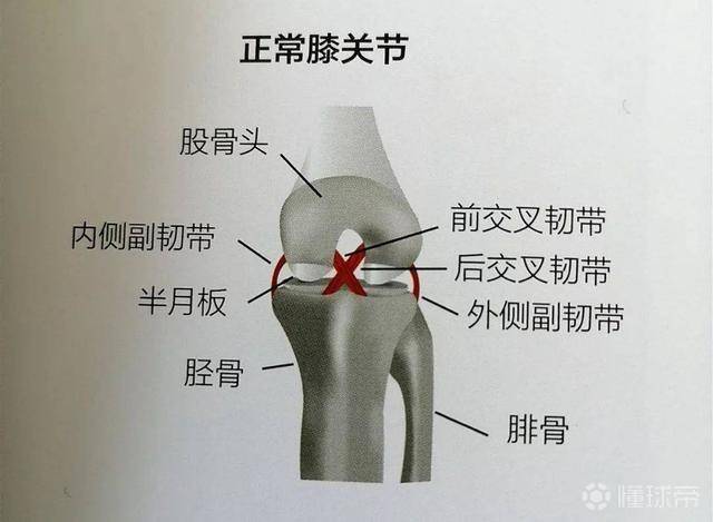 后交叉韧带的位置图片图片