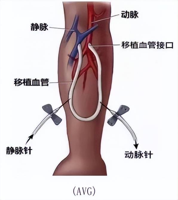 肘部动脉的位置图片图片