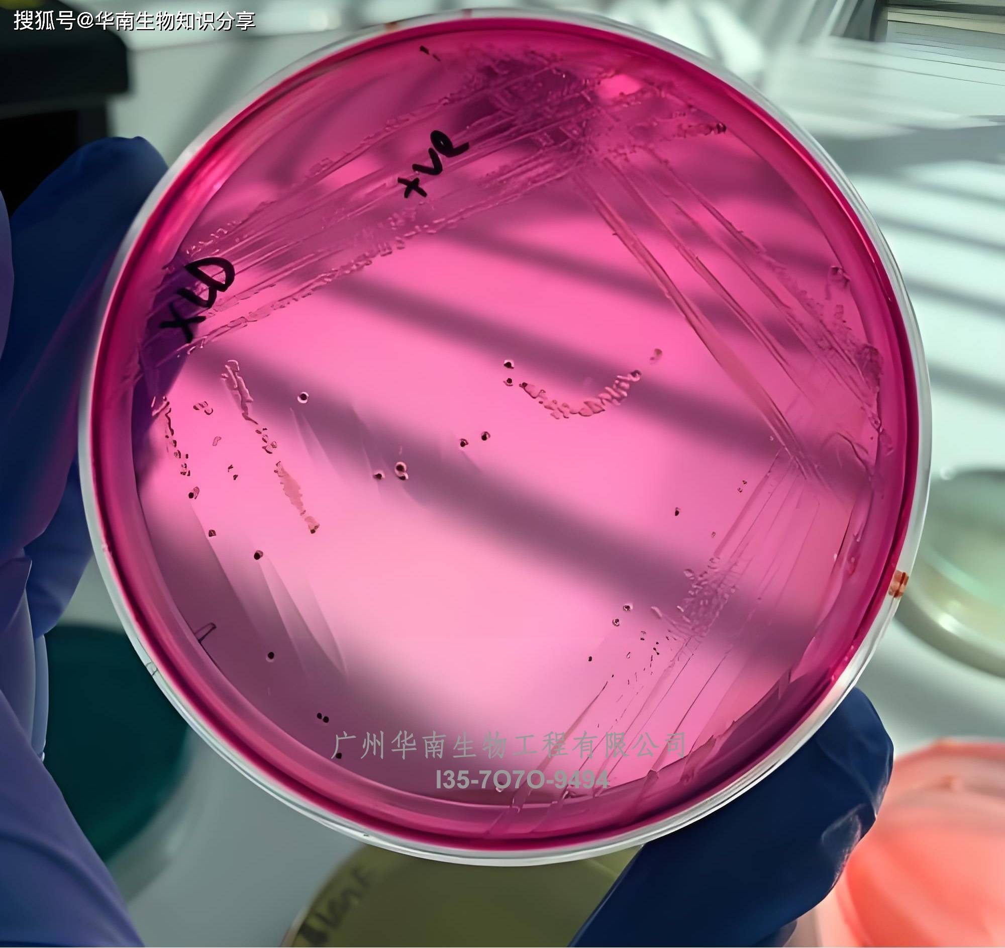 igmp,igm偏高 igmp,igm偏高