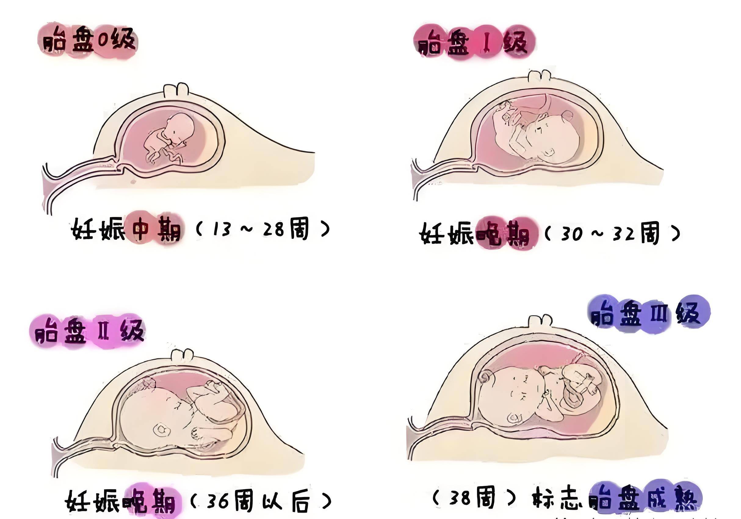 胎盘“几成熟”是宝宝出生的最佳时间?各位孕妈心里一定要有杆秤_胎儿_孕妇_情况