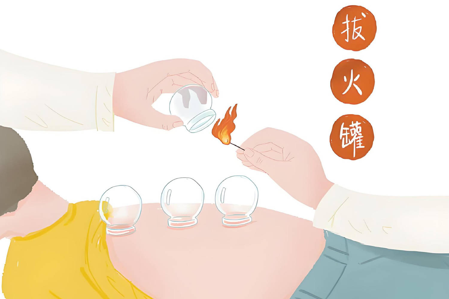 针灸和拔罐的神奇之处,北京劲松中西医结合医院中医科科普