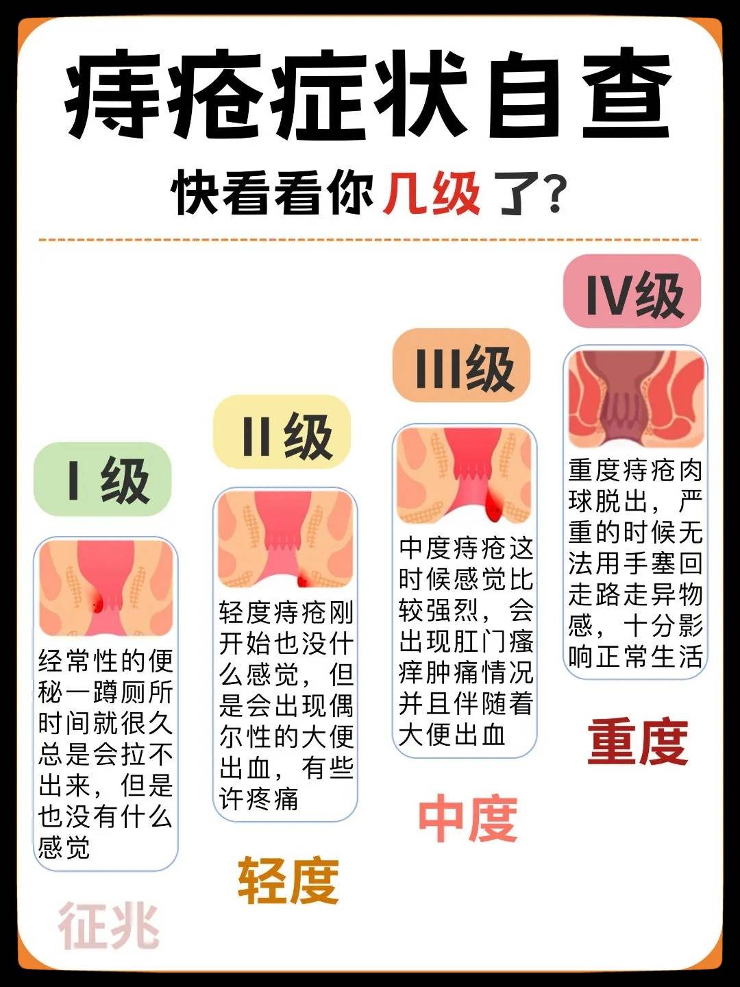 外痔初期 表现图片