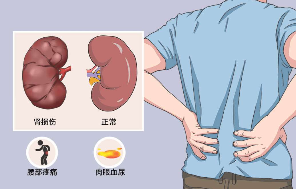 肾脏病是由多种复杂因素引发的肾脏结构和功能损害,包括遗传,感染