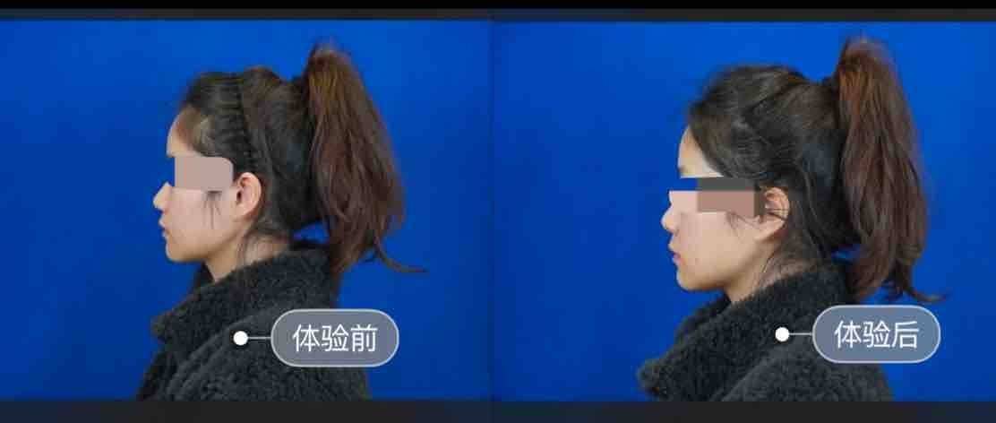 消费者质问上海薇琳医美医德何在 “医美不美”或成维权难题(图3)