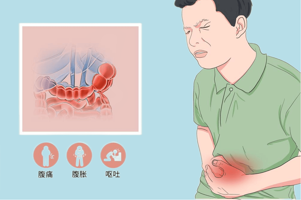 肠梗阻的常见病因有哪些?