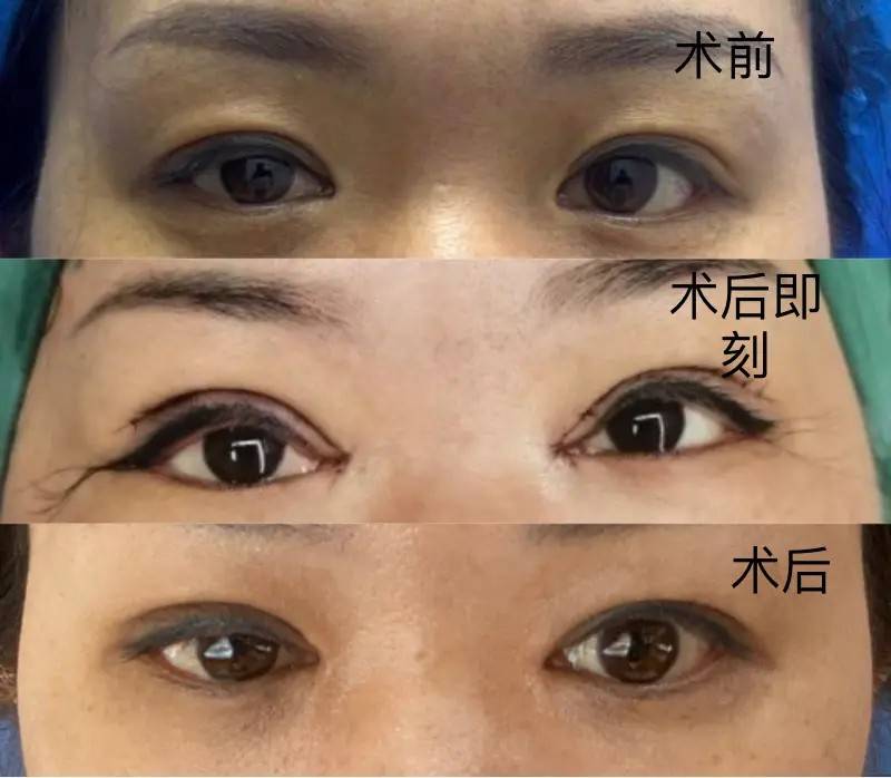 成都华欣美辰陷医患纠纷持久角力:术后效果认定各执一词(图3)