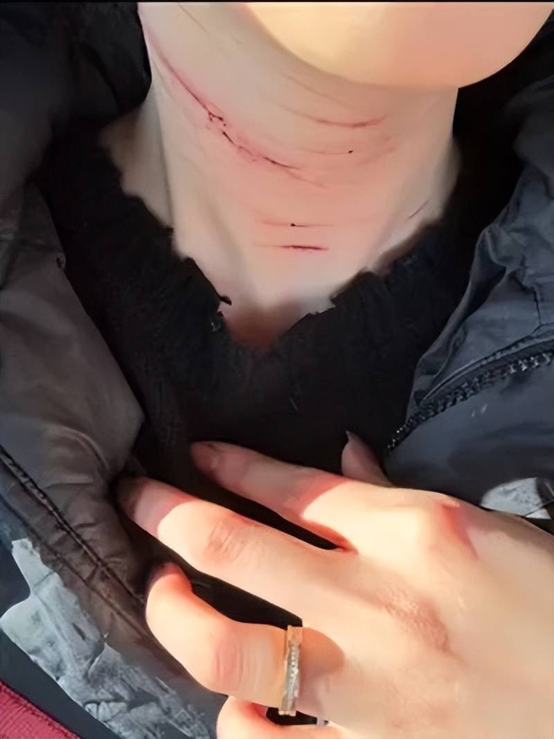 前男友公开金赛纶自残照,称她的死与金秀贤无关