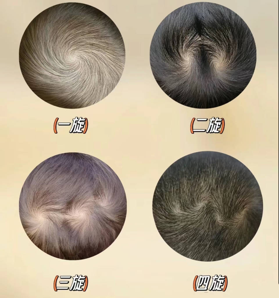 孩子头顶"两个旋",到底代表什么?很多父母不明白,看完涨知识