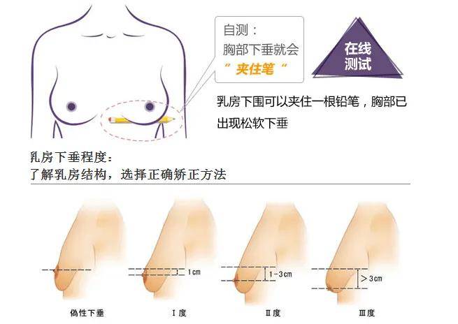 胸大=有沟？盘点关于女性胸部的4大误解