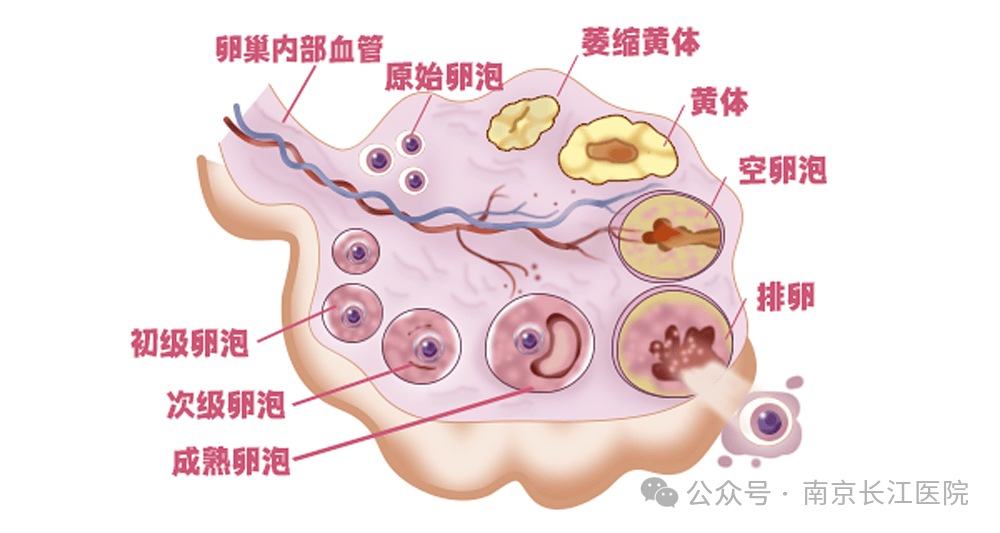 南京长江科普多囊卵巢综合征对女性生育及长期健康的影响