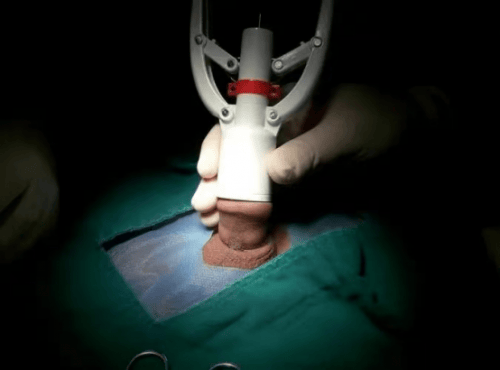 放下"包"袱,绽放青春精彩!