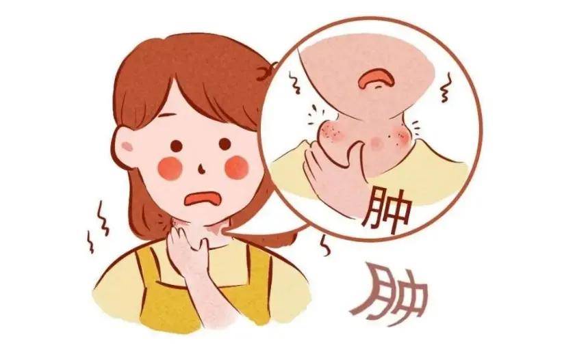 1,甲状腺结节:脖子粗大不一定就是甲状腺结节,要根据具体情况来看