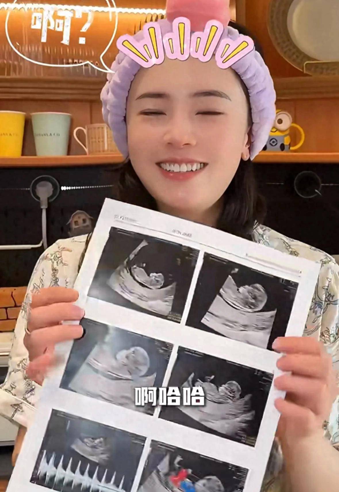 田志希晒b超照官宣怀孕,老公徐克性侵禁赛十年,爱情依然坚定