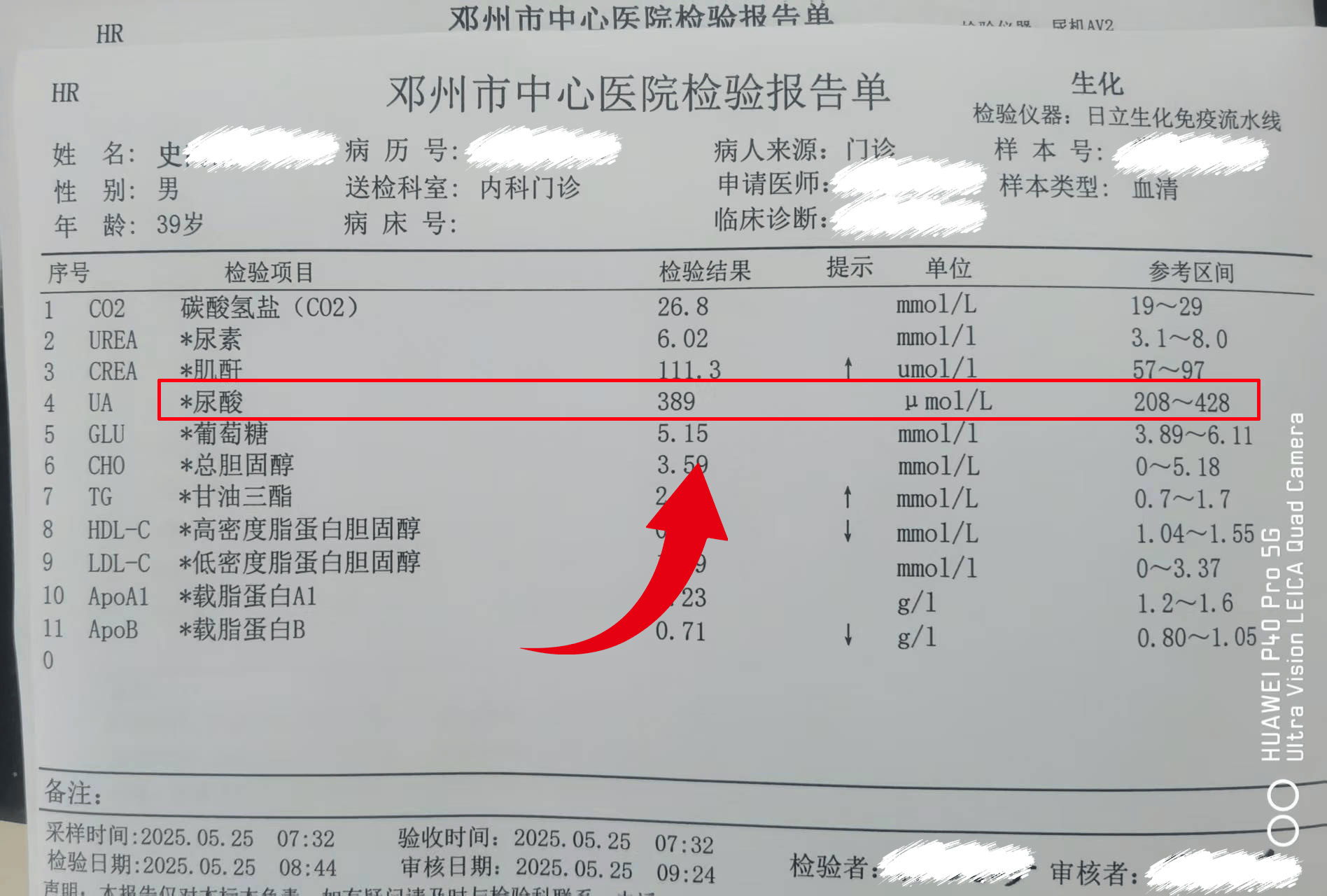尿酸559 到 389,他的亲身经历:找对方法,1 个月就见效